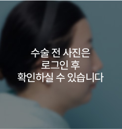 BEFORE 측면