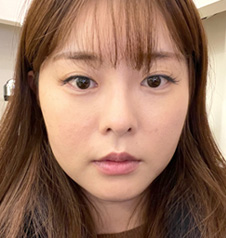 수술 전