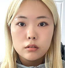 수술 전