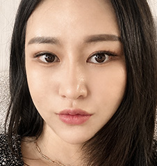 수술 후