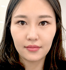 수술 전
