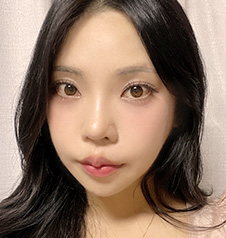 수술 후
