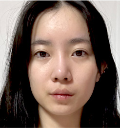 BEFORE 정면