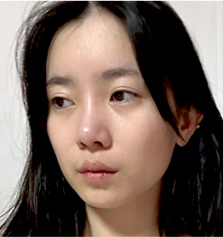 BEFORE 45도