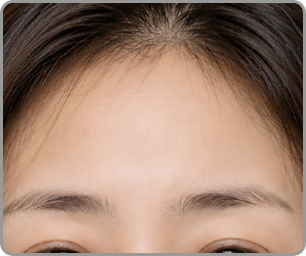 이마