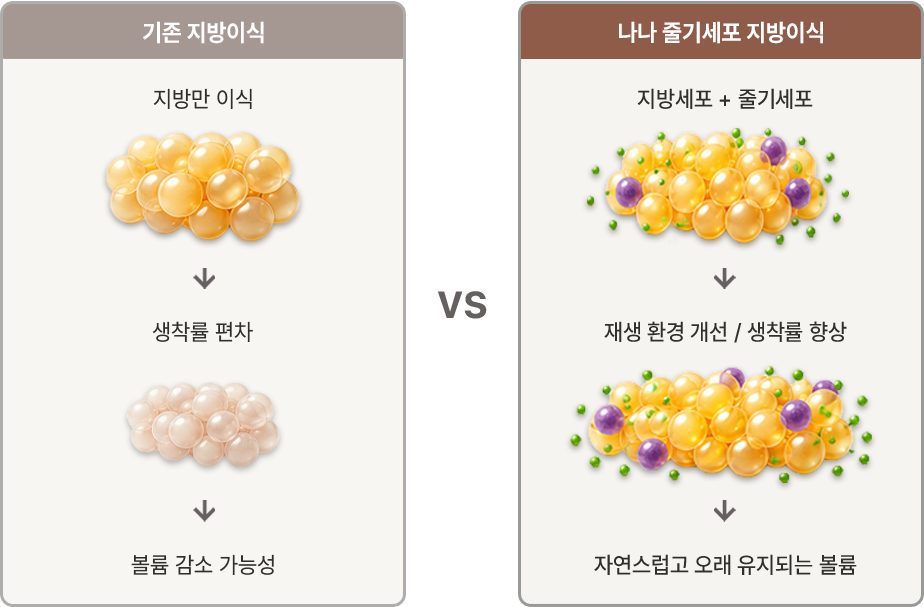 지방이식과 줄기세포를 함께 사용하는 원리 설명 이미지