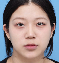 AFTER 정면